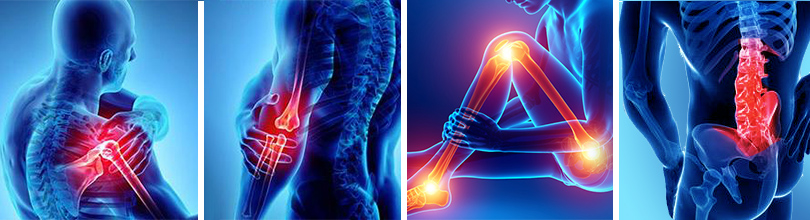 anatomy of joint issues