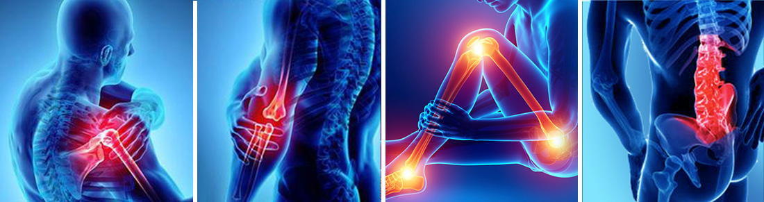 anatomy of joint issues