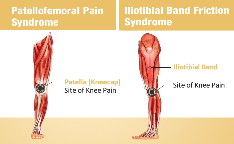 Avoid Rowing Machine Knee Pain